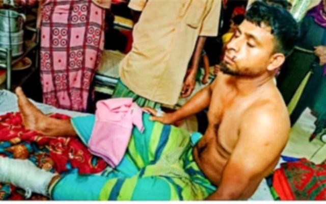 নাসিরনগরে যুবকের পায়ের রগ কেটে দেওয়ার অভিযোগ