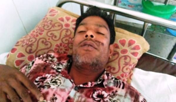 মধুপুরে তুচ্ছ ঘটনাকে কেন্দ্র করে ১জনকে কুপিয়ে আহত থানায় মামলা