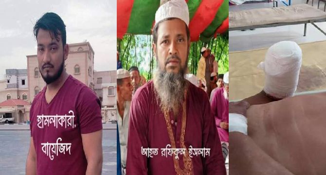 নবীনগরে ভাতিজার দায়ের কুপে চাচার হাতের কব্জি কর্তন