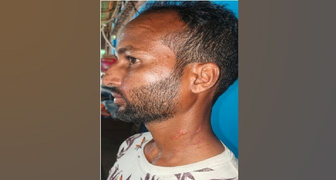 সাপাহারে জমিজমা সংক্রান্ত বিরোধের জেরে মারপিট! আহত-১