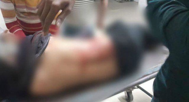 খুলনা নগরীর লবনচরা হরিনটানায় রাজু নামের এক যুবক দুর্বৃত্তদের গুলিতে আহত হয়েছেন