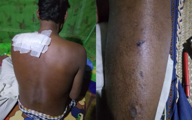 গোদাগাড়ীতে মাছ ব্যবসায়ীকে কুপিয়ে নগদ টাকা ও মোবাইল ছিনতাই