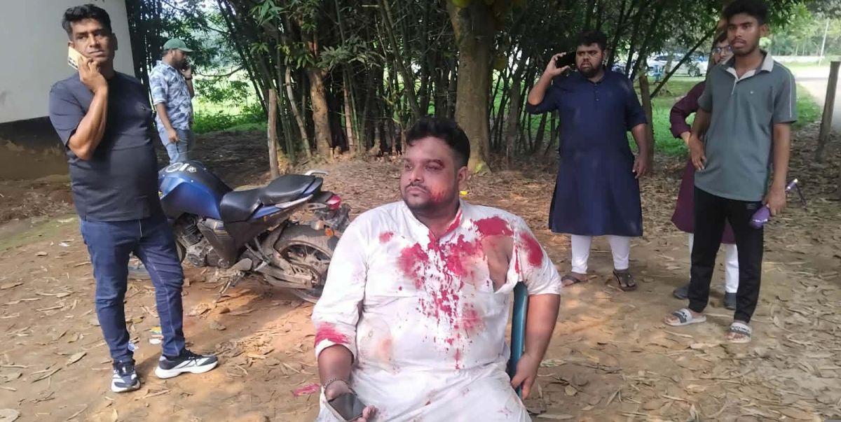 রূপগঞ্জে পুলিশের সামনেই এনসিপির নেতা কর্মীদের উপর বিএনপির হামলা আহত- ১০