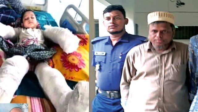 ভুল চিকিৎসায় পঙ্গু হলেন শিশু তানভীর, স্যাকমো শফিক গ্রেফতার