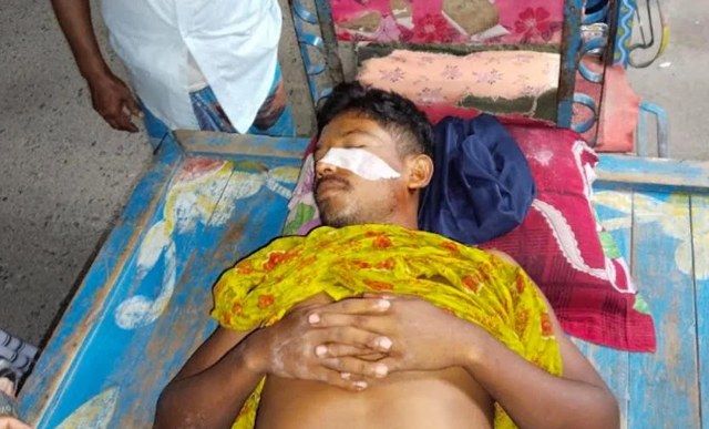 নীলফামারীতে ট্রেন থেকে ছোড়া ঢিলে যুবক আহত, হাসপাতালে ভর্তি