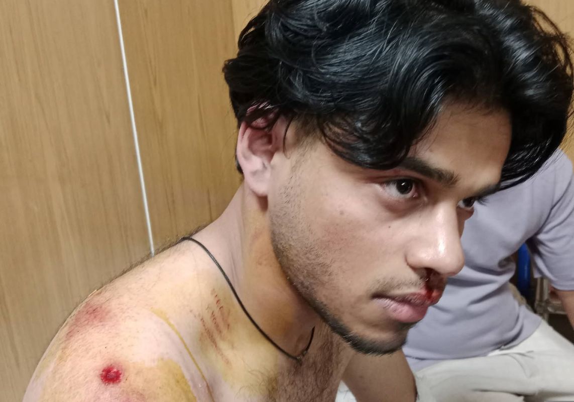 ঝালকাঠিতে স্বতন্ত্র প্রার্থীর  নির্বাচন কর্মীদের উপর সন্ত্রাসী হামলায় আহত ২