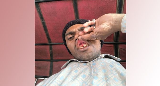 যাত্রাবাড়ীতে পাওনা টাকা চাওয়ায় হিন্দু যুবকের উপর হামলা