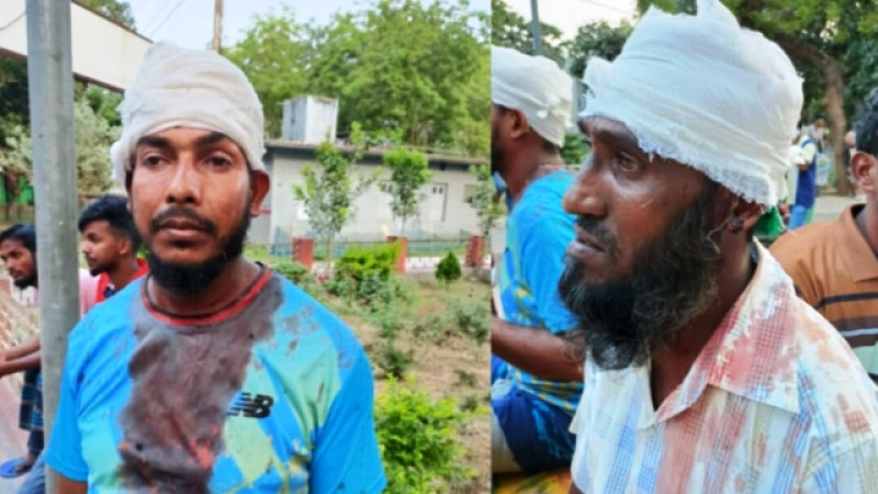 তানোরে তুচ্ছ ঘটনা কে কেন্দ্র করে দেশীয় অস্ত্র নিয়ে মারপিট আহত ৪