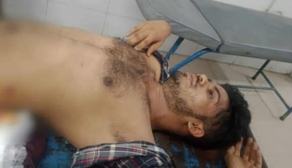 খুলনায় ২ নম্বর কাস্টমস ঘাটে মোঃ সোহেল নামে এক যুবককে গুলি করেছে দুর্বৃত্তরা