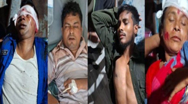 খুলনার রূপসা চৌরাস্তা সংলগ্ন মহাসড়কে সড়ক দুর্ঘটনায় পুলিশ কর্মকর্তাসহ পাঁচ জন গুরুতর আহত