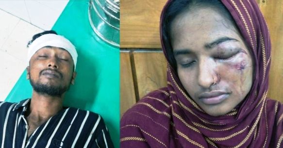 ভোলার তজুমদ্দিনে যুবদল কর্মীকে মারধরের অভিযোগ, আহত-২
