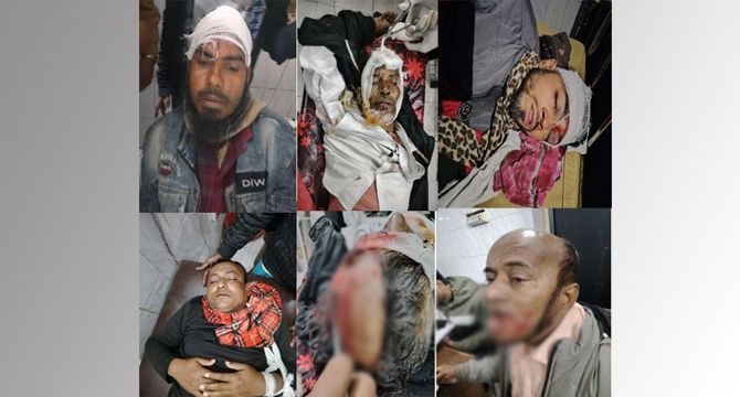 ভোলার লালমোহনে বিএনপি ও জামায়াত সমর্থিত বিডিপি নেতা-কর্মীদের মধ্যে সংঘর্ষ ॥ আহত-৩০