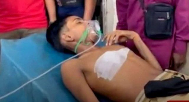 খুলনার রায়ের মহল সংলগ্নে শান্ত নামের এক কিশোর  দুর্বৃত্তের গুলিতে আহত হয়েছে