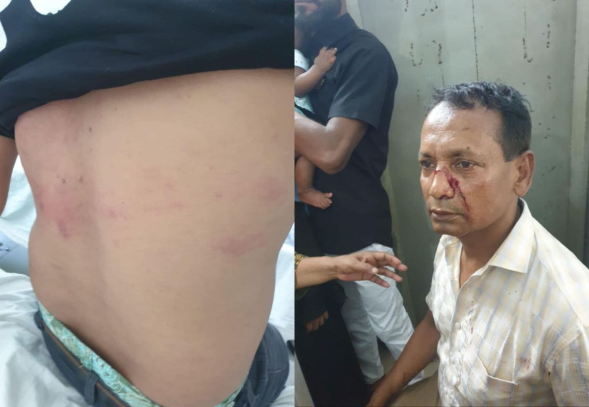 সিরাজদিখানে মাদরাসার আয় ব্যয়ের হিসাব চাওয়াকে কেন্দ্র করে প্রতিপক্ষের হামলায় আহত-৪