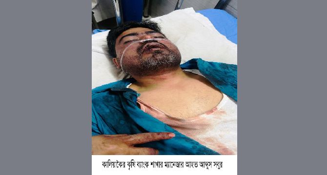 কৃষি ব্যাংকের ম্যানেজারকে অপহরণ হাতুরি দিয়ে পিটিয়ে মুক্তিপণ আদায়