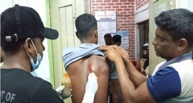 মোংলায় চিংড়ি ঘের দখলকে কেন্দ্র করে দু’গ্রুপের রক্তক্ষয়ী সংঘর্ষে আহত ৯. এলাকায় চরম উত্তেজনা