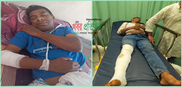 তিতাস গ্যাসের নিরাপত্তা বিভাগের দলনেতা সাবেক যুবদল নেতা গাজী জহিরুল ইসলাম জুলাই-আগস্ট গণঅভ্যুত্থানে আহত একজন জুলাই যোদ্ধা