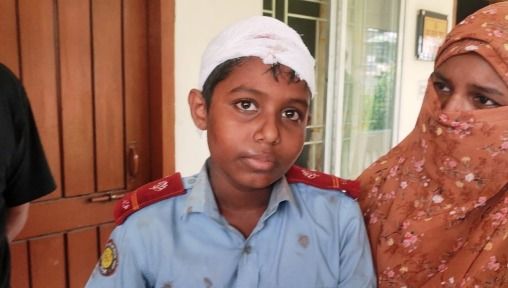ক্লাস রুমে চলন্ত ফ্যান মাথায় পড়ে শিক্ষার্থী আহত