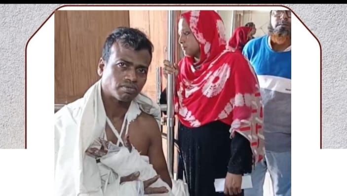 লবণচরায় দারোগার ভিটা নামক স্থানে দুর্বৃত্তরা মোবাইলের মাধ্যমে ডেকে নিয়ে দুই হাতে কব্জি কেটে দেয়