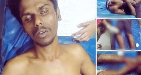 খুলনার রুপসা আইচগাতী নামক স্থানে ফয়সাল নামের এক যুবকের দুই পা কেটে নিয়েছে দুর্বৃত্তরা