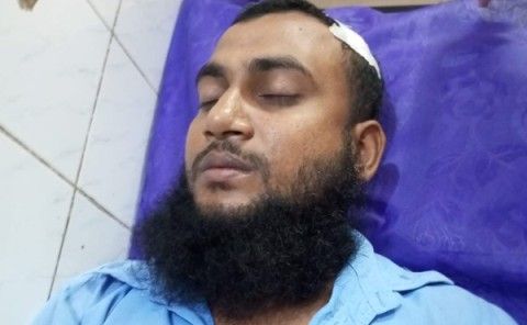 কুষ্টিয়ায় পল্লীবিদ্যুতের লাইনম্যানকে গুলি !