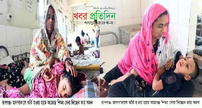 রূপগঞ্জে হামের প্রাদুর্ভাব বৃদ্ধি: দুই শিশুর মৃত্যু, হাসপাতালে ১৫ শিশু ভর্তি