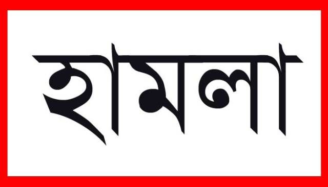 কালিয়াকৈরে অগ্নিকান্ডের ঘটনায় ফায়ার সার্ভিসের গাড়িতে হামলা