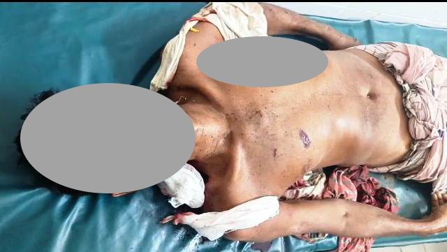 দলীয় প্রতিপক্ষের বোমা হামলার বেনাপোলে বিএনপি কর্মি নিহত